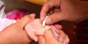 挑积，一针千年的客家医技守护童心